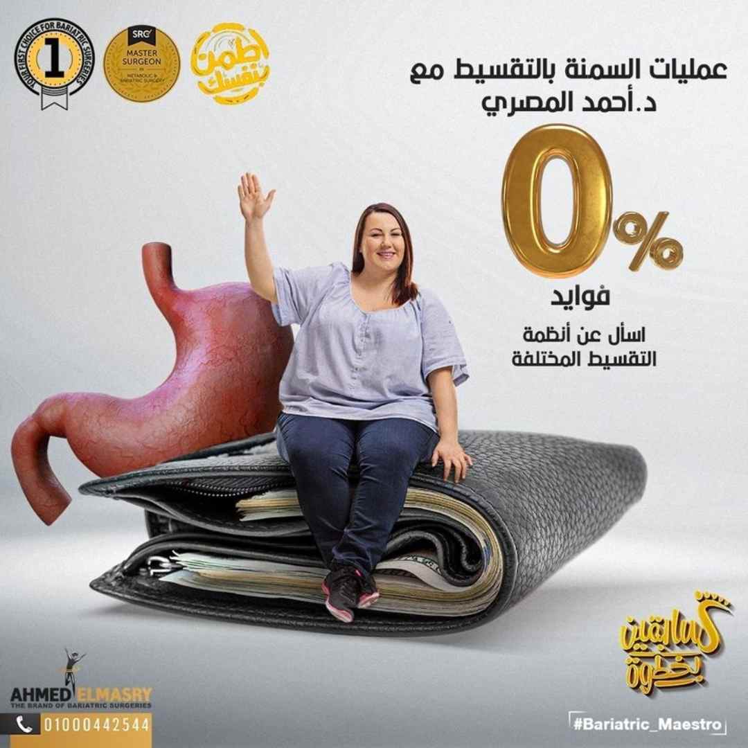 عملية تكميم المعدة بالتقسيط